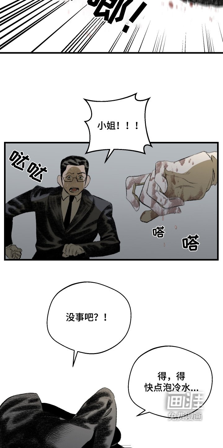 第81章：烧伤