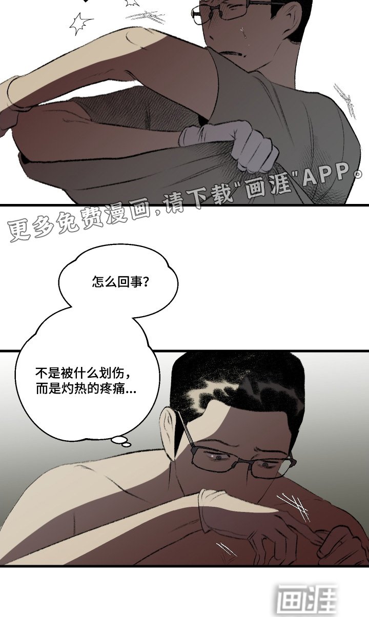 第81章：烧伤