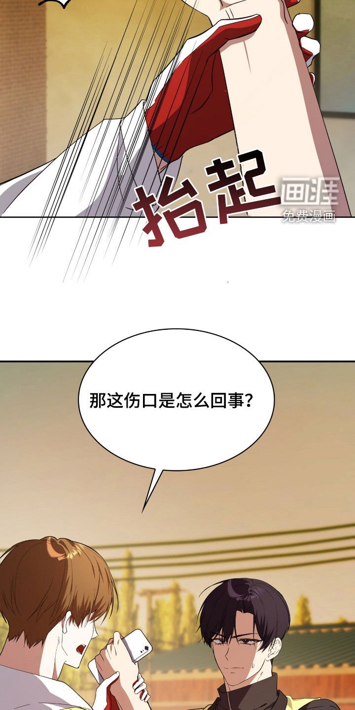 第94章：【第二季】受伤
