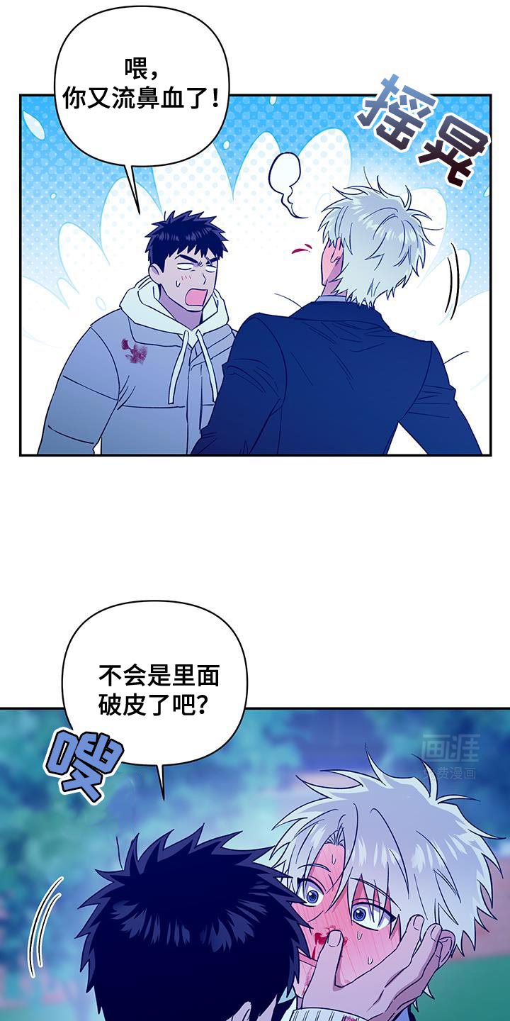 第49章：流鼻血