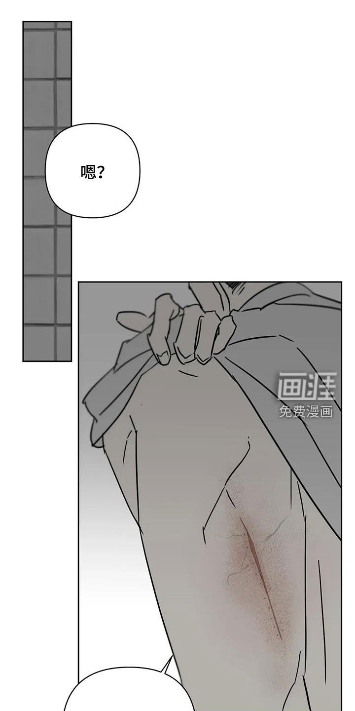第50章：伤口