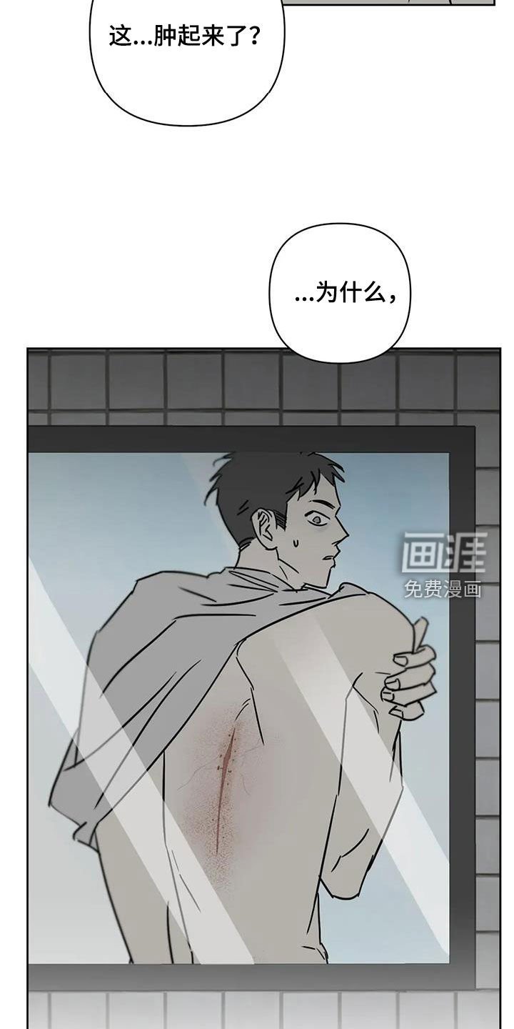 第50章：伤口