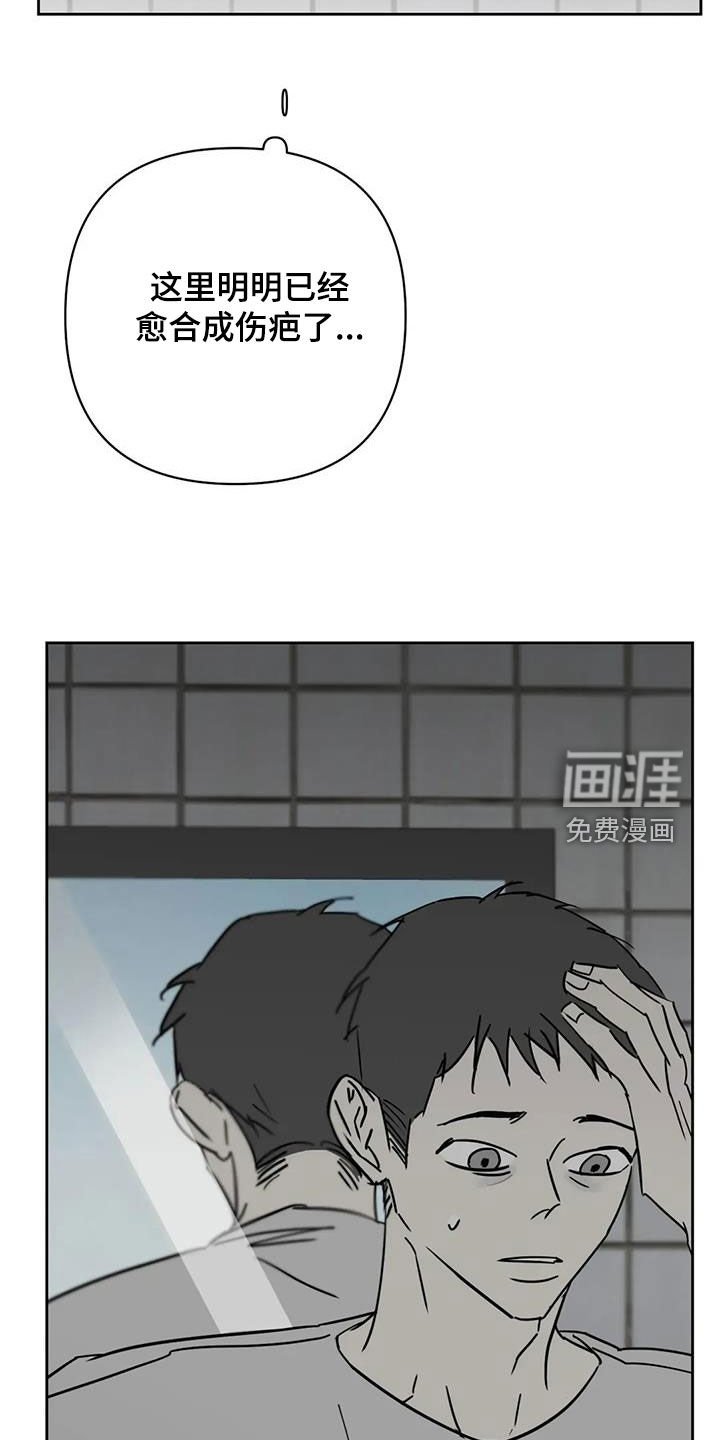 第50章：伤口
