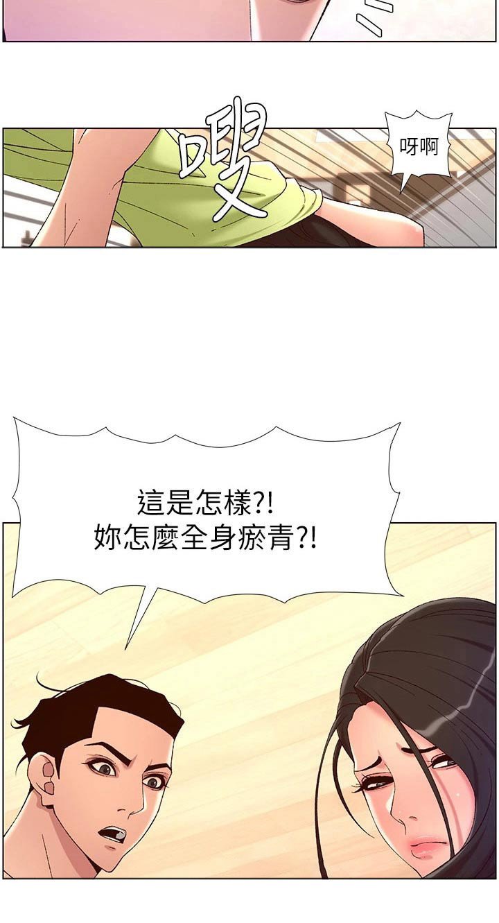 第44章：淤青