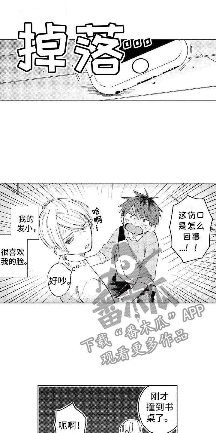 第4章：受伤也不赖