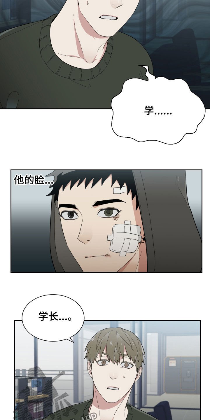 第14章：鼻青脸肿
