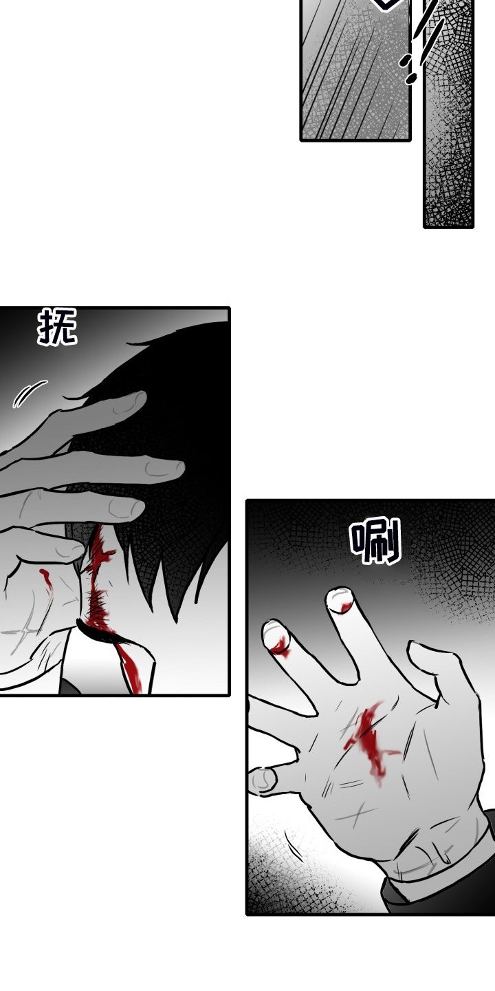 第68章：【第二季】挡伤