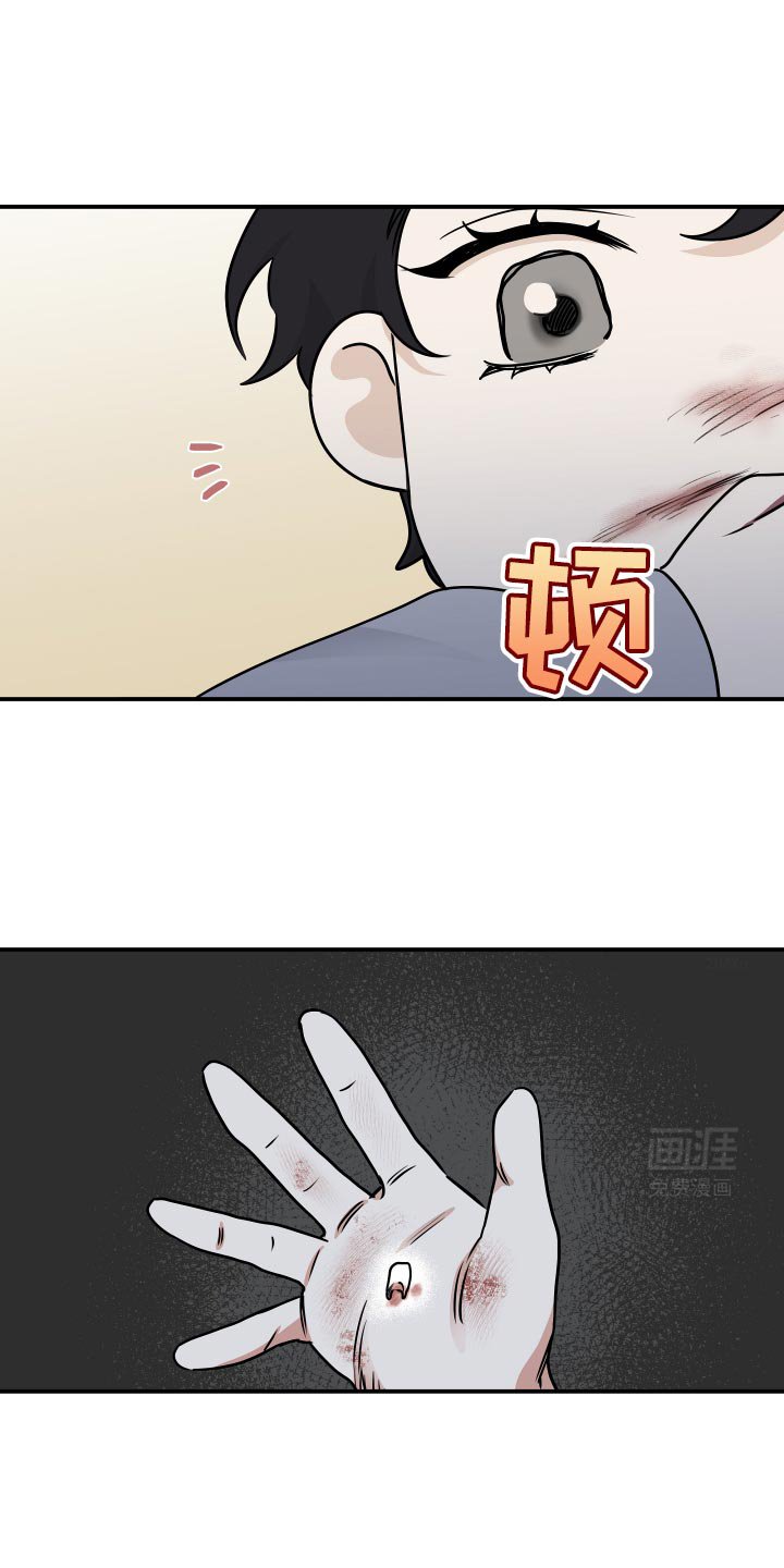 第149章：【第三季】掉牙