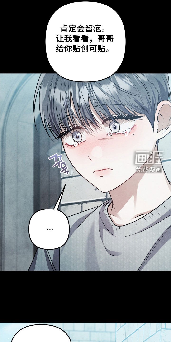 第31章：哥哥我好痛