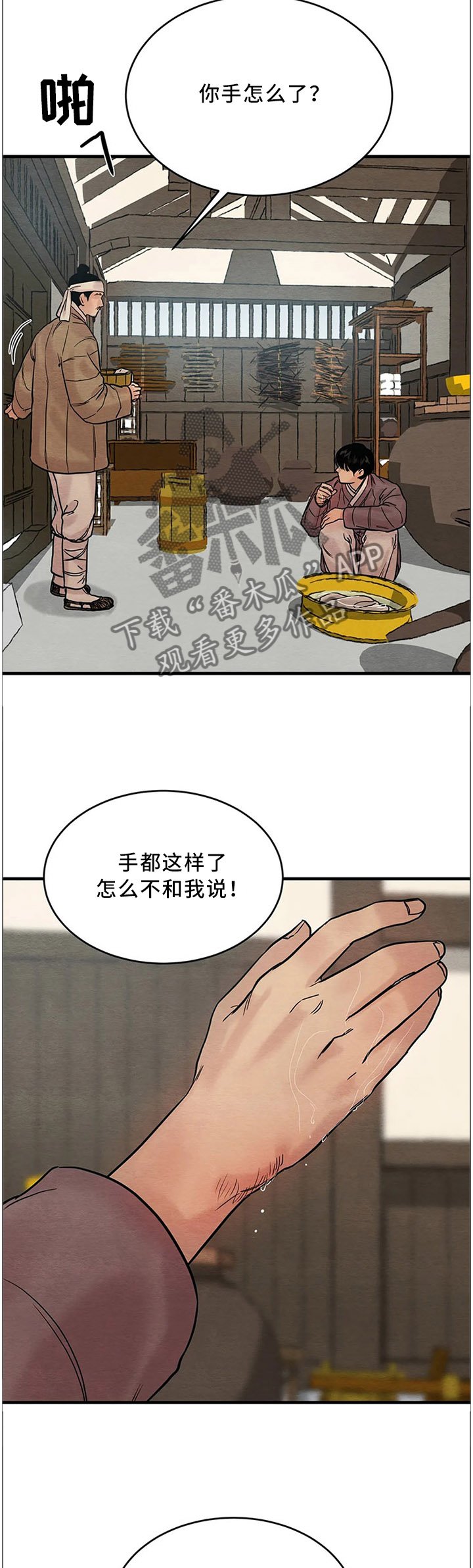 第85章：【第二季】受伤