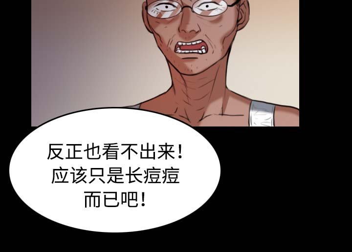 第56章：无条件支持