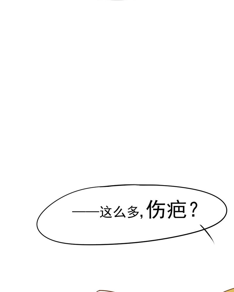 第13章：刮痧