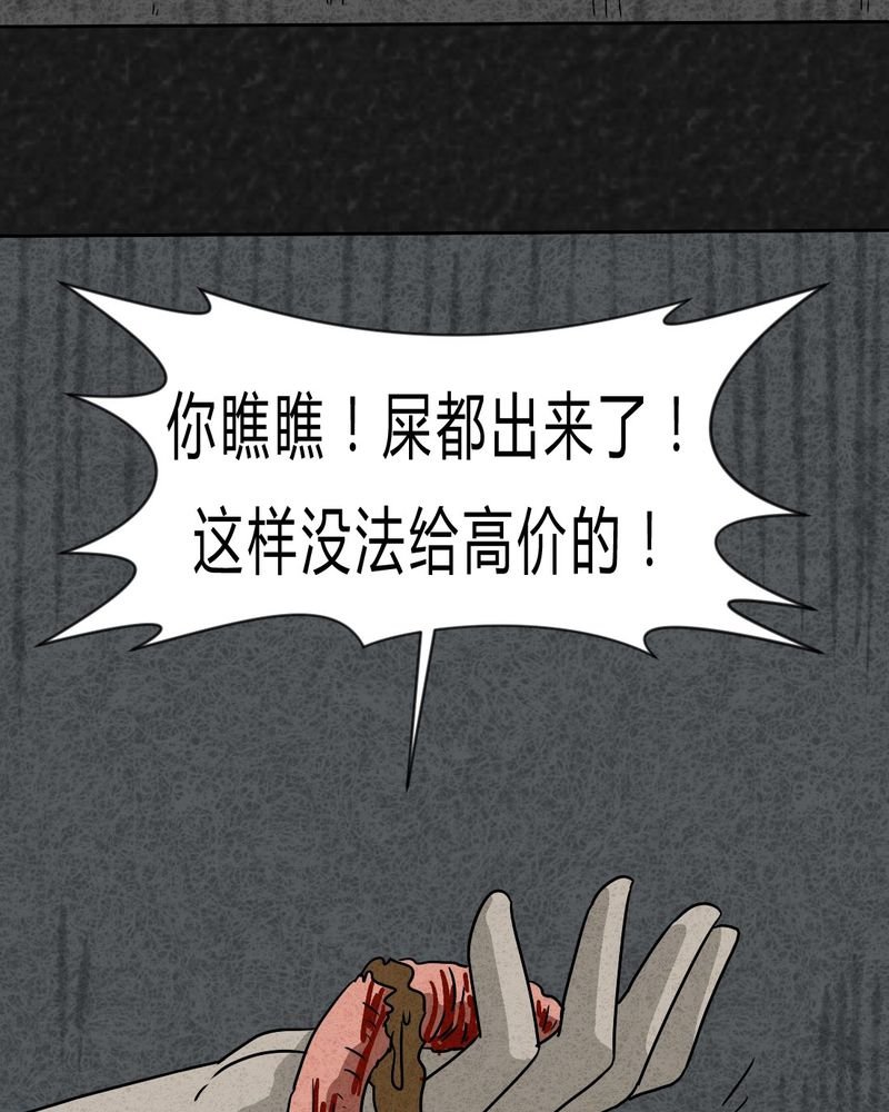第20章：内脏大盗上
