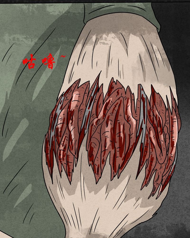 第21章：内脏大盗下