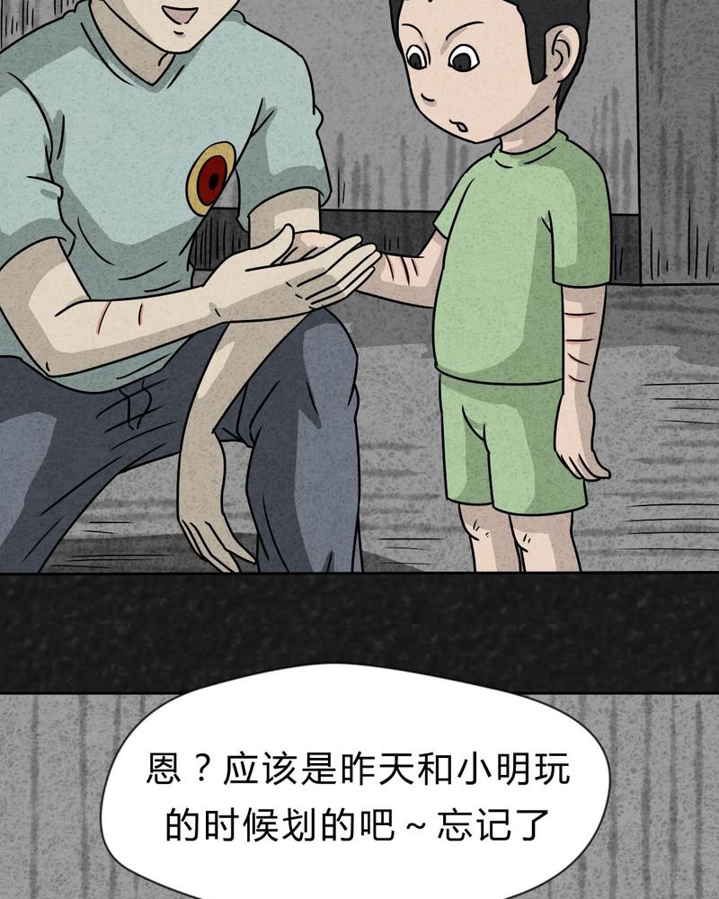 第22章：划痕