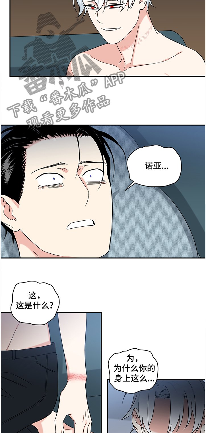 第82章：【后记】伤痕