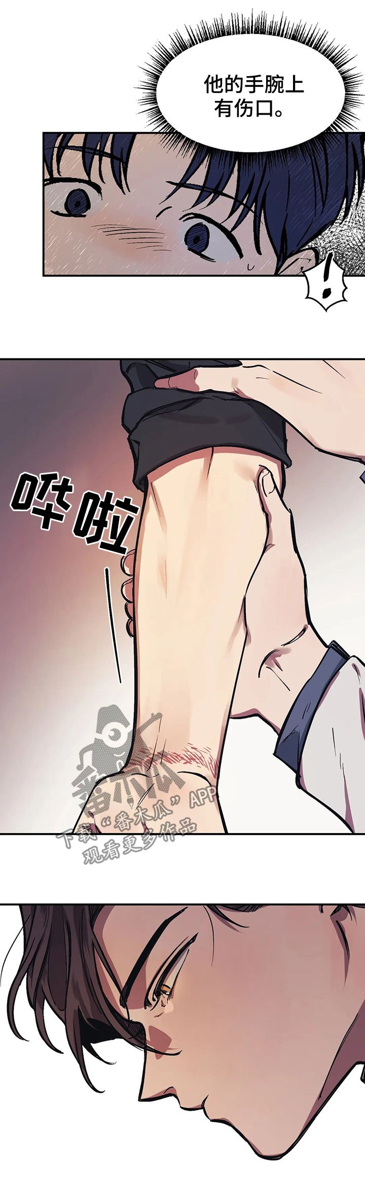 第26章：伤口