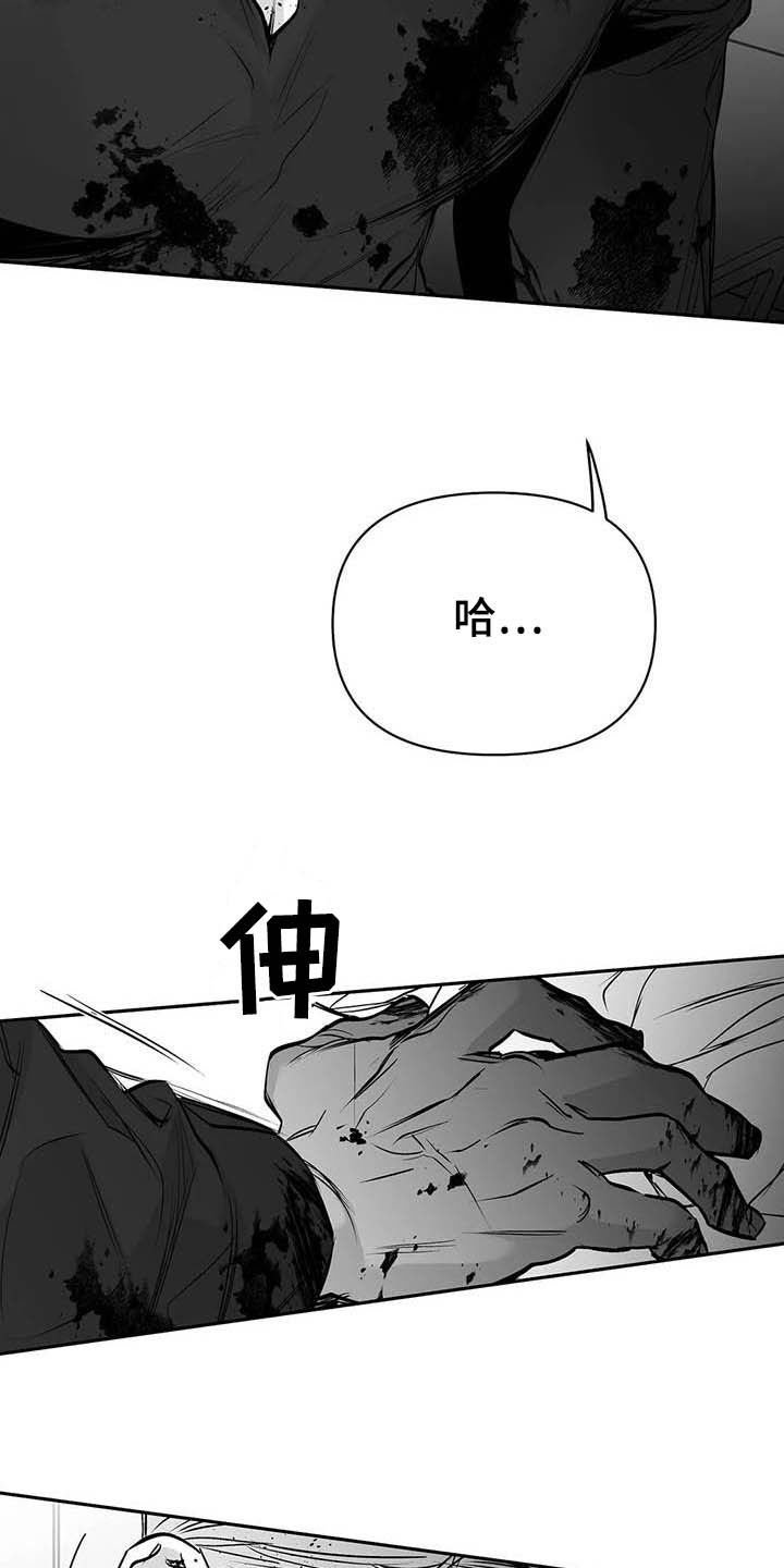 第129章：【第三季】手术