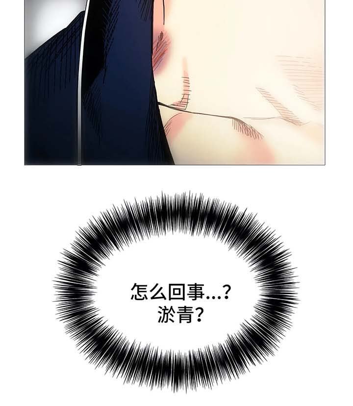 第43章：淤青