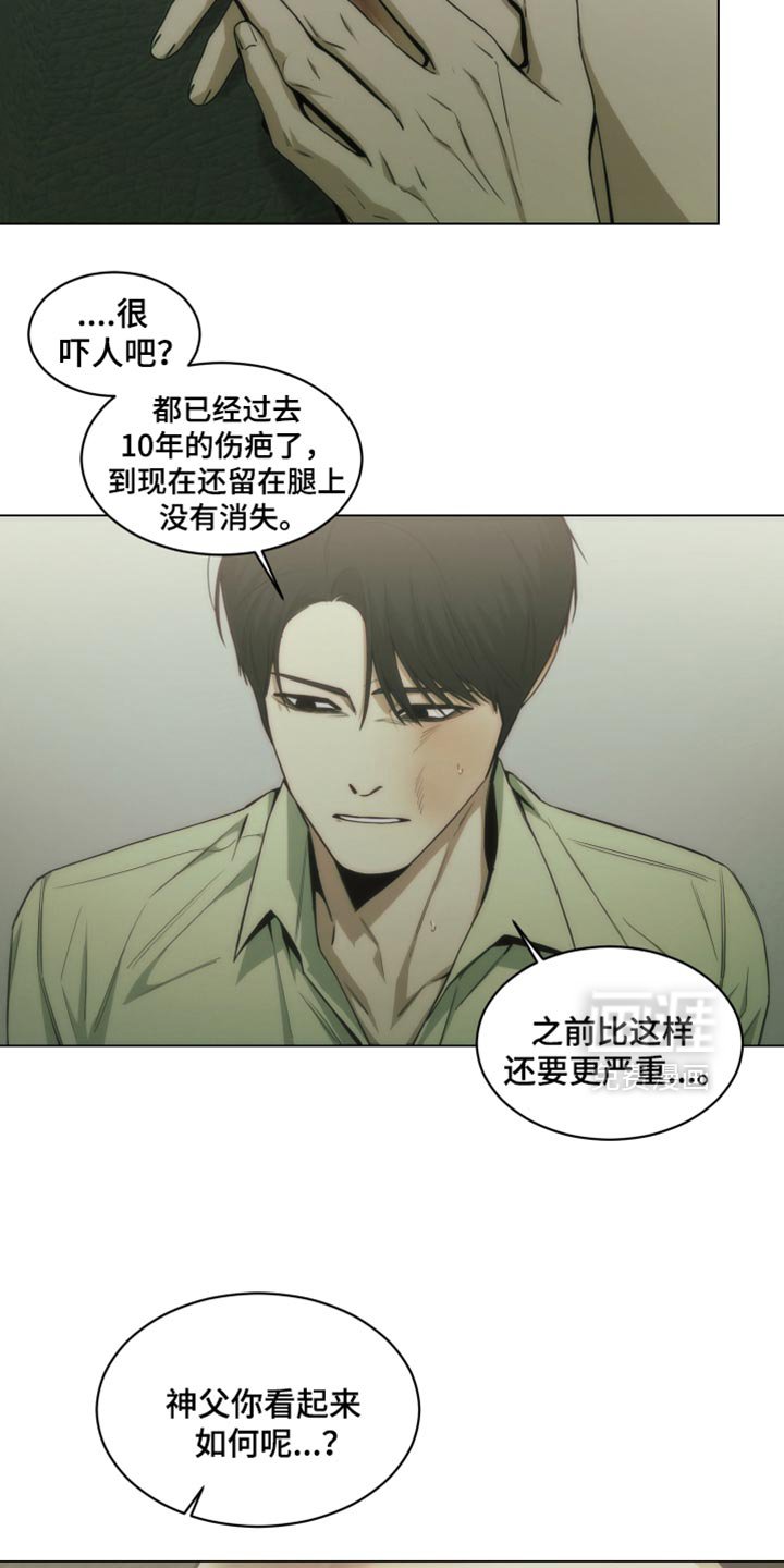 第42章：手术的疤痕